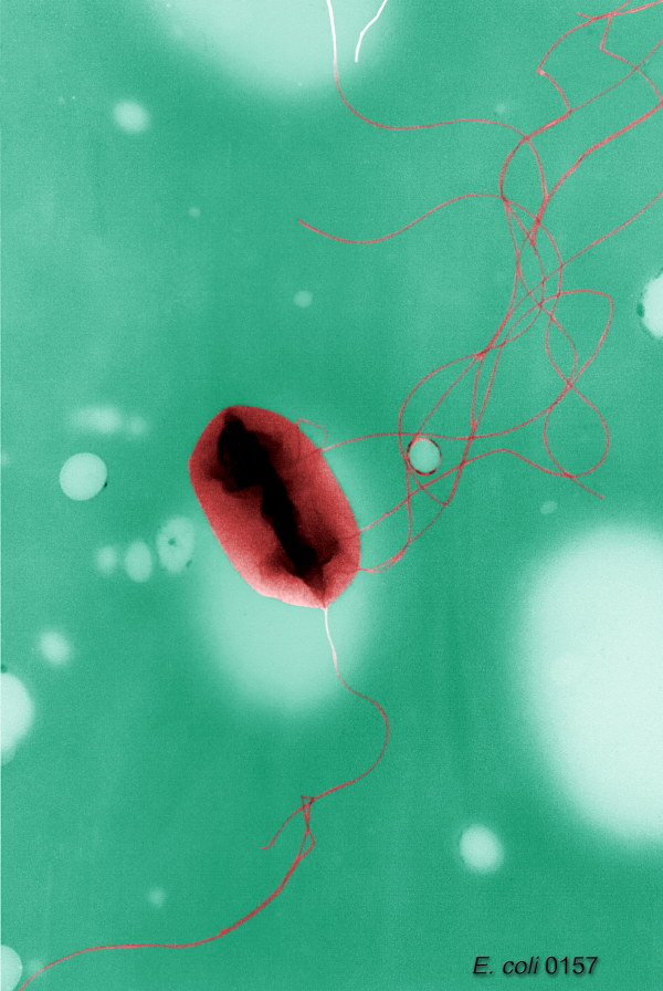 E.coli_TEM_colour